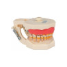 Manequim de Periodontia Padrão - Orais Manequins