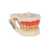 Manequim de Periodontia Padrão - Orais Manequins